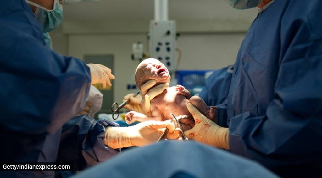 When do doctors recommend a caesarean delivery?