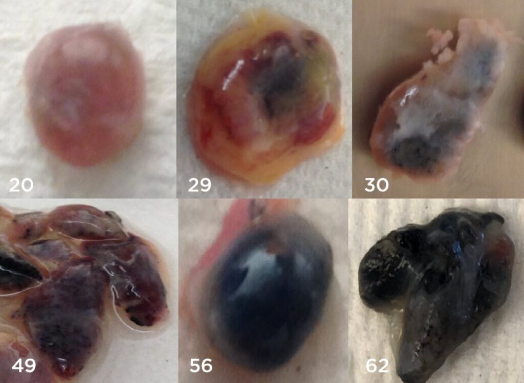 Decades of air pollution undermine the immune system, lymph nodes study finds