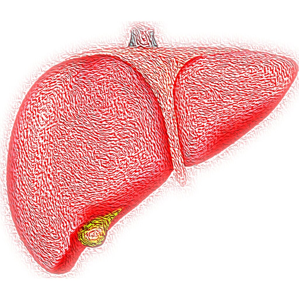 First-degree relatives of patients with NAFLD are at risk of liver disease