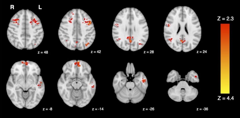 Study suggests that even brief exposure to air pollution has rapid impacts on the brain