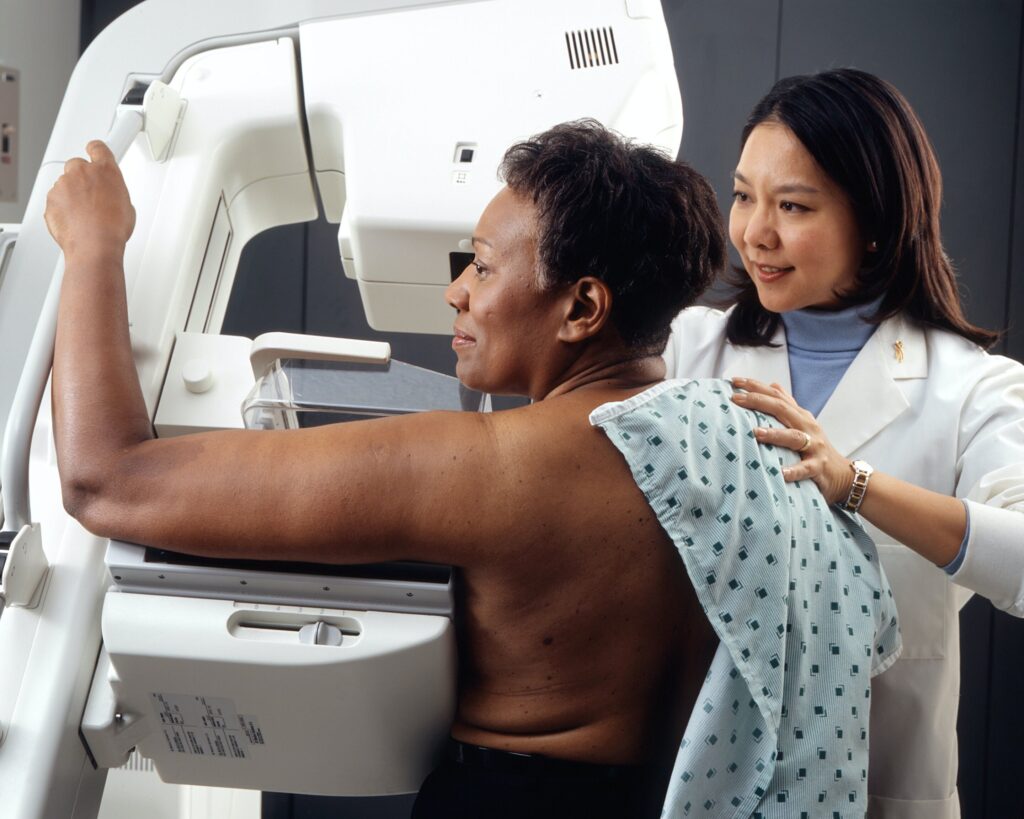 Obstacles for breast cancer prevention in high-risk Black women