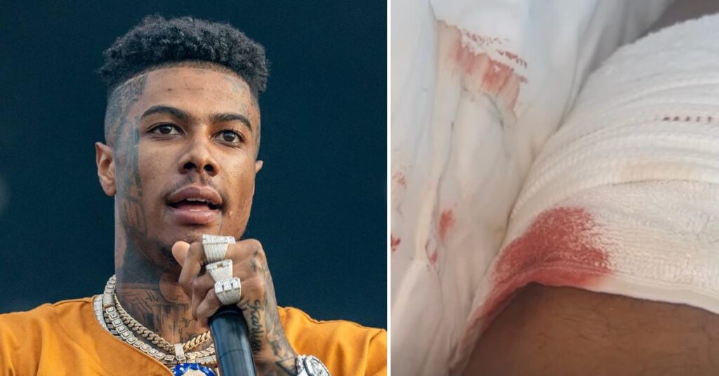 Blueface Stabbed During Confrontation at Gym