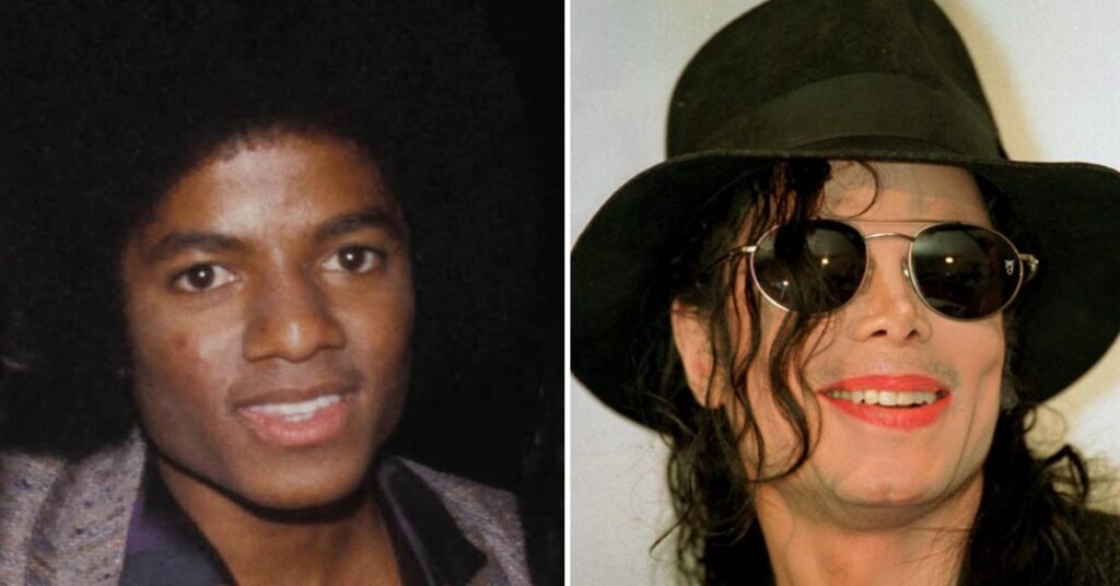 Michael Jackson's Ex-Bodyguard Shares 'Real Reason' Late Pop Star Underwent Nose Surgery