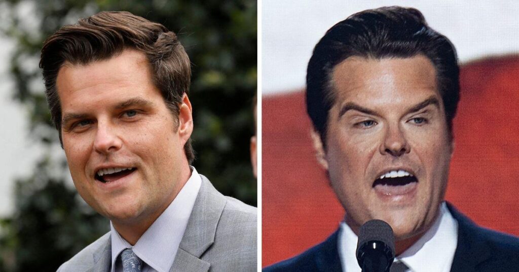 What Happened to Matt Gaetz's Face? See His Shocking Transformation