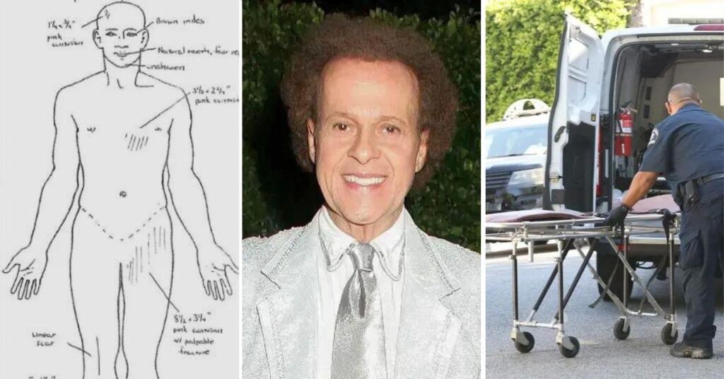 Forensic Expert's Theory on 'What Really Killed' Richard Simmons