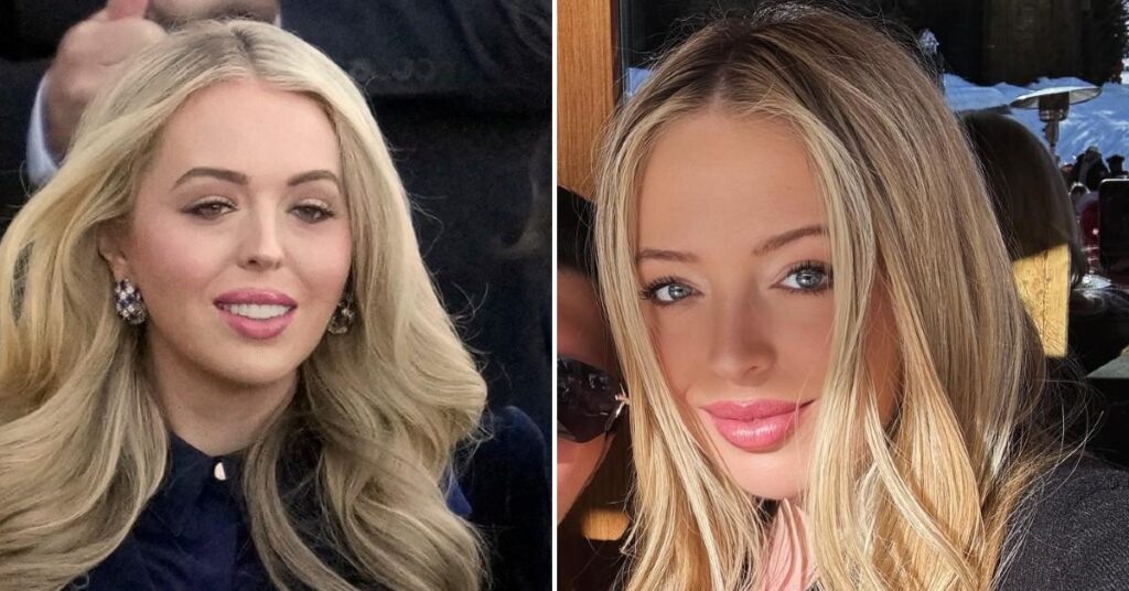 Did Tiffany Trump Get Lip Fillers? Top Doc Weighs In