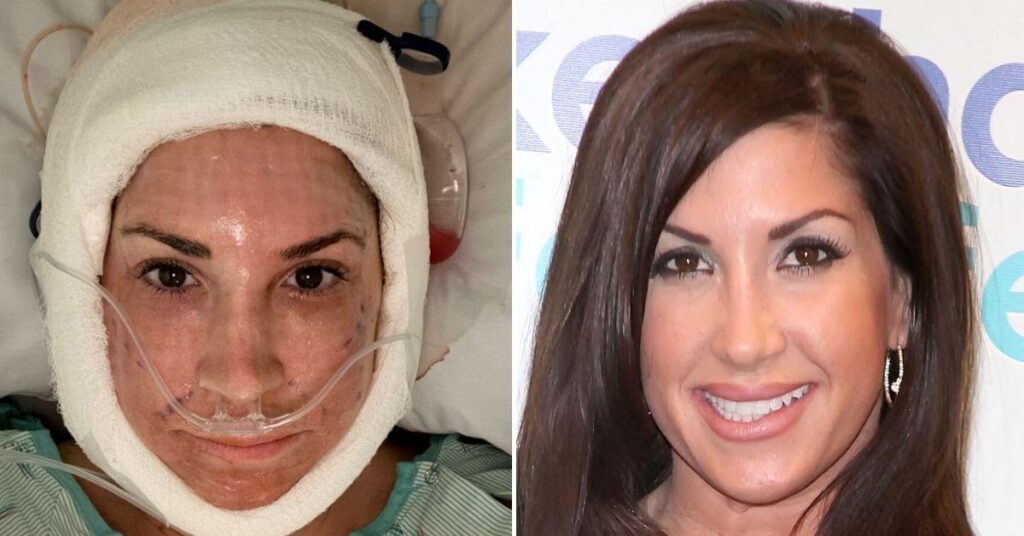 'Real Housewives' Star, 55, Posts Shocking Post-Op Video After Facelift