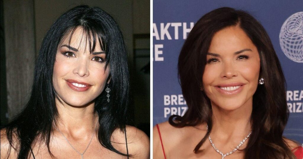 Lauren Sanchez’s Plastic Surgery: Before & After Photos Lauren Sanchez's Plastic Surgery: Before & After Photos