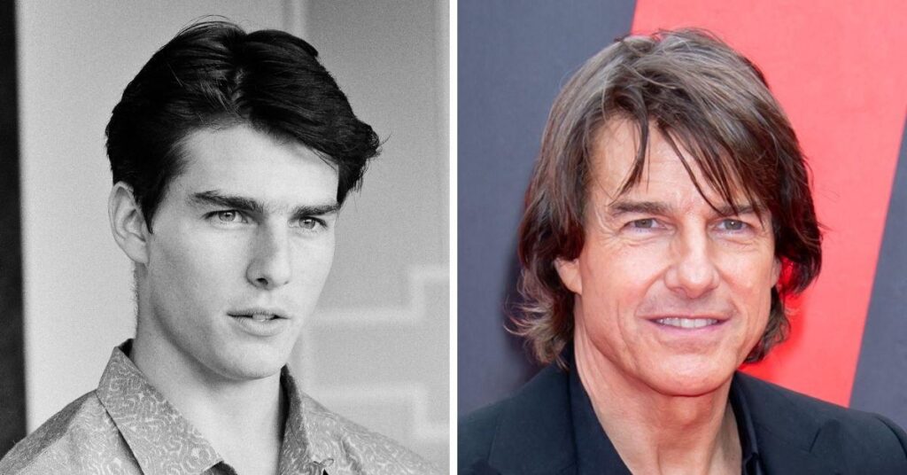 Has Tom Cruise Had Plastic Surgery? See Before & After Photos