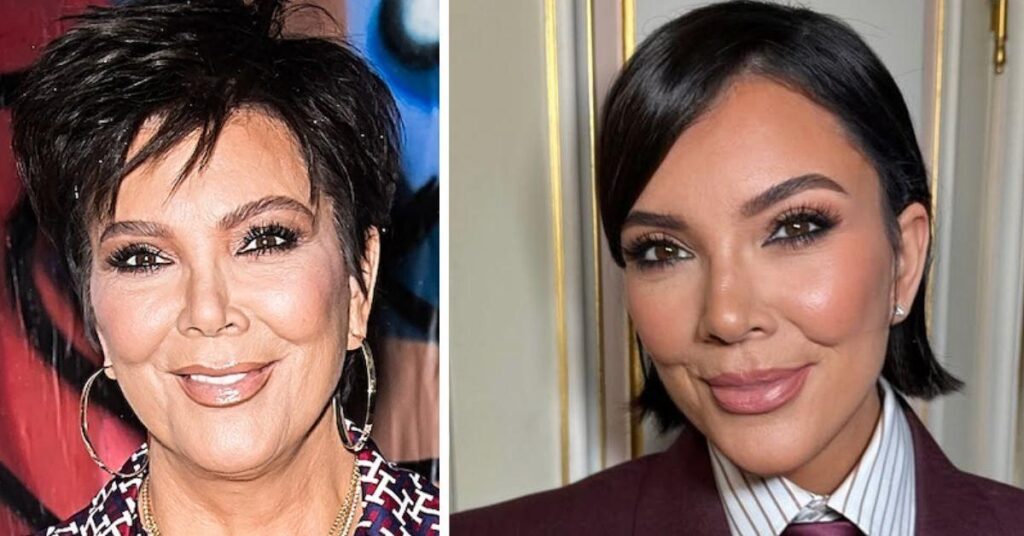 Kris Jenner's Extreme Plastic Surgery Routine For Her Drastic New Look
