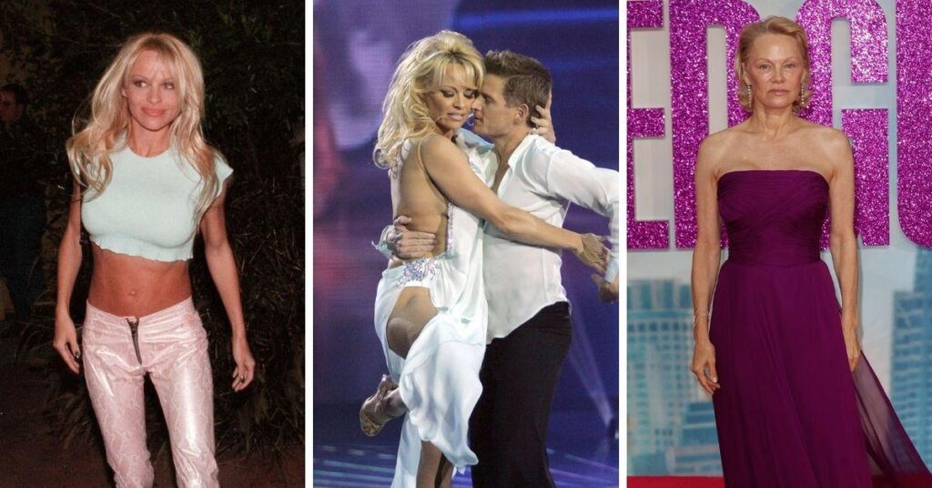 Pamela Anderson's Before and After Photos Revealed