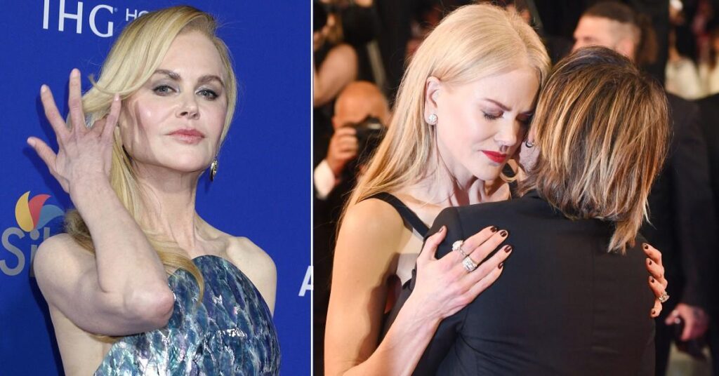 Nicole Kidman Marriage Split Secrets — Weight Loss Sparks Concern