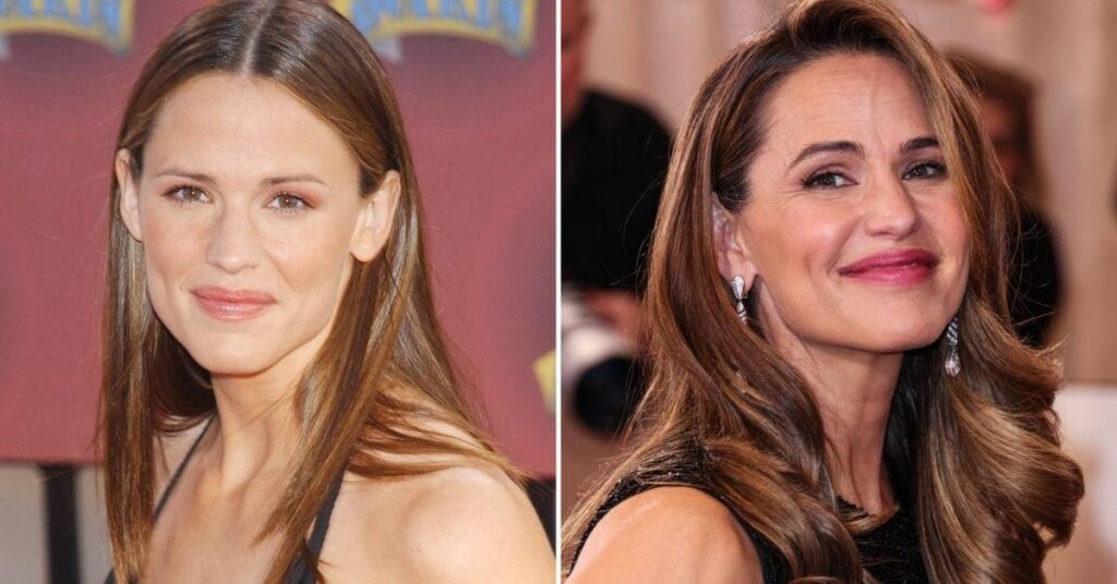 How Jennifer Garner Maintained 'Ageless' Appearance Without Surgery