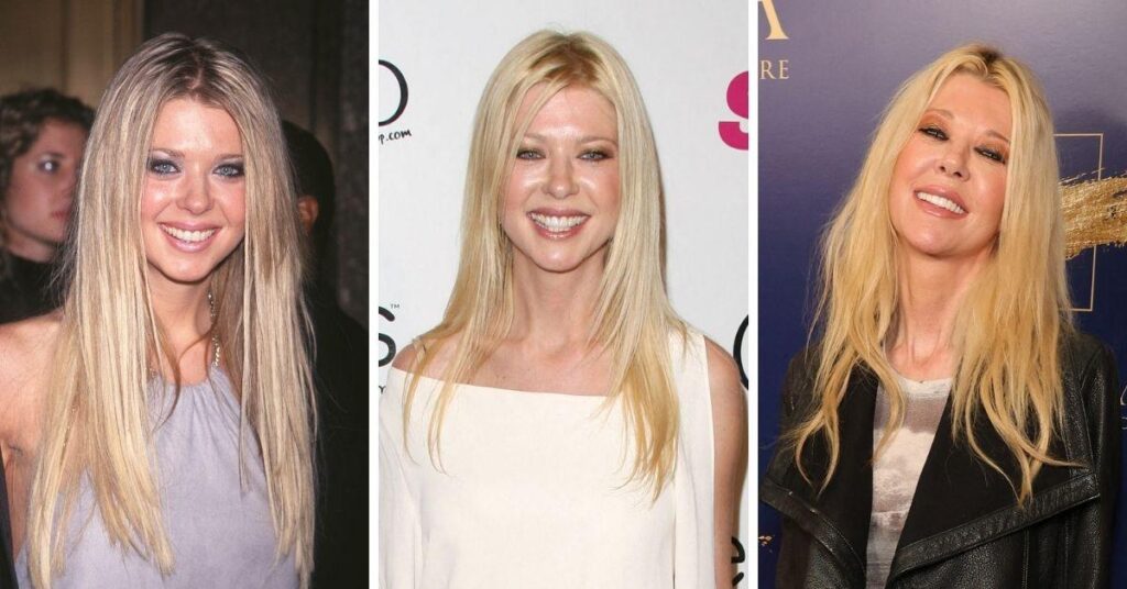 Inside Tara Reid's Shocking Transformation After Botched Plastic Surgery