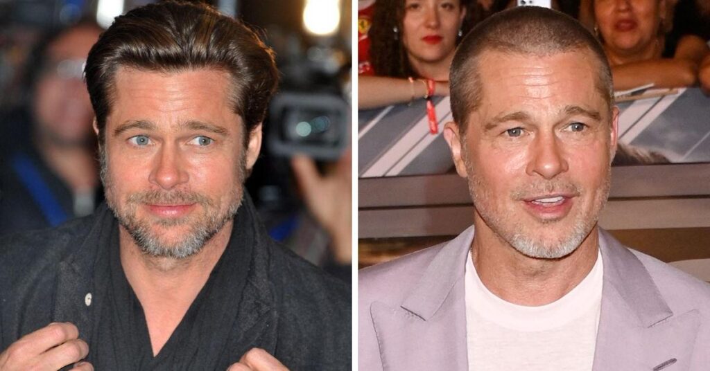 Inside Brad Pitt’s Plastic Surgery Rumors Following Signs of a ‘Facelift’ Inside Brad Pitt's Plastic Surgery Rumors Following Signs of a 'Facelift'