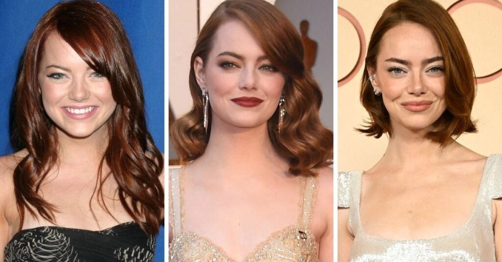 Emma Stone’s Transformation Revealed Amid Plastic Surgery Rumors Emma Stone's Transformation Revealed Amid Plastic Surgery Rumors